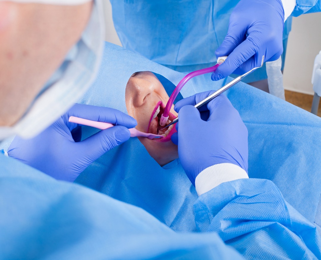 Cirugía Dental: Soluciones Avanzadas para una Salud Bucal Integral.