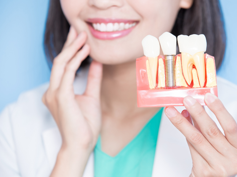 Ventajas de los implantes dentales: la mejor opción para recuperar tu sonrisa